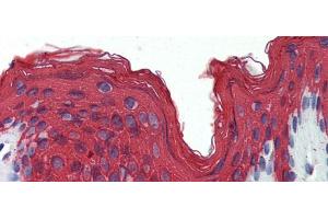 Rabbit Anti-KRT1 Antibody  arp42278 Paraffin Embedded Tissue: Human Skin Antibody Concentration: 1. (Cytokeratin 1 antibody  (Middle Region))