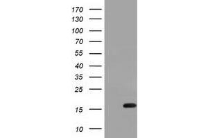 HEK293T cells were transfected with the pCMV6-ENTRY control (Left lane) or pCMV6-ENTRY IL1F6 (Right lane) cDNA for 48 hrs and lysed. (IL36A/IL1F6 antibody)