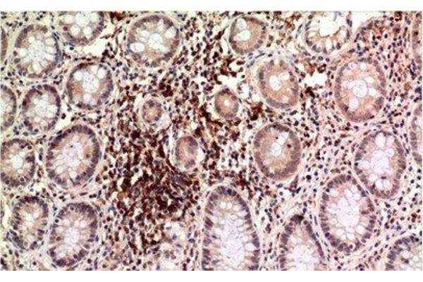 TUBE1 antibody