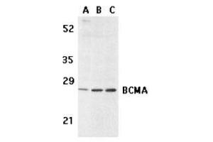 Western blot analysis of BCMA in human spleen (A) tissue lysate, K562 (B), and U937 (C) cell lysates with AP30133PU-N BCMA antibody at 5 μg/ml.