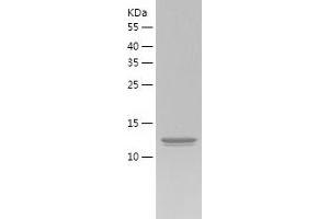 Western Blotting (WB) image for Interleukin 1 eta (FIL1h) (AA 5-157) protein (His tag) (ABIN7123515) (FIL1h Protein (AA 5-157) (His tag))