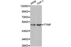 Western blot analysis of extracts of various cell lines, using TYMP antibody. (Thymidine Phosphorylase antibody  (AA 1-200))