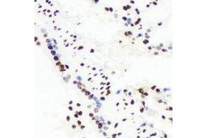 Immunohistochemical analysis of RbAp48 staining in mouse lung formalin fixed paraffin embedded tissue section. (Retinoblastoma Binding Protein 4 antibody)