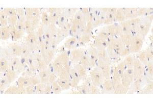 Immunohistochemistry (IHC) image for anti-Protein Kinase, AMP-Activated, gamma 1 Non-Catalytic Subunit (PRKAG1) (AA 70-300) antibody (ABIN7439723)