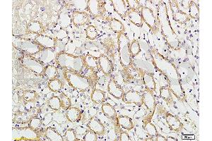 Formalin-fixed and paraffin embedded mouse kidney labeled with Rabbit Anti-APG5L/ATG5 Polyclonal Antibody (ABIN752413) at 1:100 followed by conjugation to the secondary antibody and DAB staining.