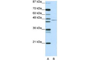 WB Suggested Anti-TRIM14 Antibody   Titration: 2. (TRIM14 antibody  (N-Term))