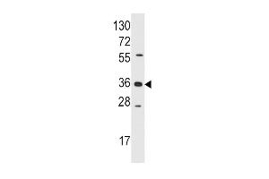 Western blot analysis of anti-AKR1B1 Pab (ABIN389206 and ABIN2839364) in Jurkat cell line lysates (35 μg/lane). (AKR1B1 antibody  (AA 102-135))