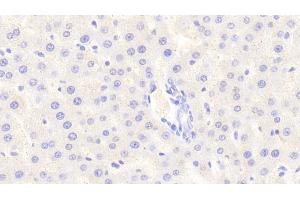 Detection of SIRT4 in Rat Liver Tissue using Polyclonal Antibody to Sirtuin 4 (SIRT4) (SIRT4 antibody  (AA 60-255))