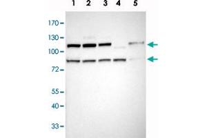 Western blot analysis of Lane 1: RT-4, Lane 2: U-251 MG, Lane 3: A-431, Lane 4: Liver, Lane 5: Tonsil with ILF3 polyclonal antibody  at 1:100-1:250 dilution. (Interleukin enhancer-binding factor 3 (ILF3) antibody)