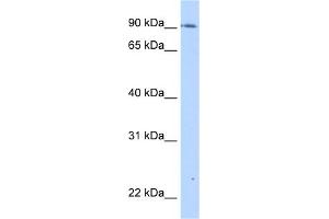 WB Suggested Anti-TMEM24 Antibody Titration:  0. (C2CD2L antibody  (C-Term))