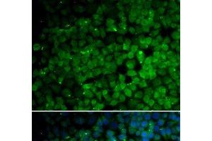 Immunofluorescence analysis of HeLa cells using TRIM13 Polyclonal Antibody (TRIM13 antibody)