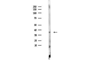 anti-Epoxide Hydrolase 3 (EPHX3) (N-Term) antibody