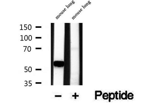 RCN2 antibody  (C-Term)