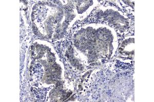 IHC analysis of Hsp105 using anti-Hsp105 antibody (ABIN5693036).