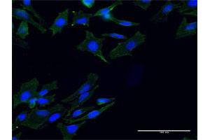 Immunofluorescence of monoclonal antibody to TLN1 on HeLa cell. (TLN1 antibody  (AA 1324-1424))