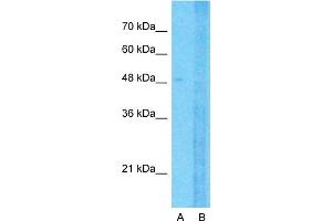 Host:  Rabbit  Target Name:  SLC12A1  Sample Type:  Jurkat  Lane A:  Primary Antibody  Lane B:  Primary Antibody + Blocking Peptide  Primary Antibody Concentration:  1ug/ml  Peptide Concentration:  5ug/ml  Lysate Quantity:  25ug/lane/lane  Gel Concentration:  0. (SLC12A1 antibody  (N-Term))