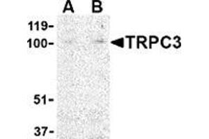 Western blot analysis of TRPC3 in mouse heart tissue lysate with this product at (A) 1 and (B) 2 μg/ml.