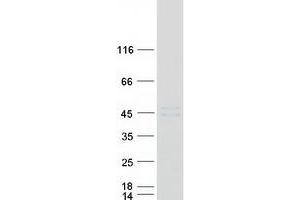 Western Blotting (WB) image for Cathepsin L1 (CTSL1) (Transcript Variant 2) protein (Myc-DYKDDDDK Tag) (ABIN2713239)