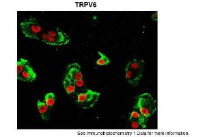 Sample Type: hRetinal pigment epithelial cellsGreen: primaryRed: nuclearPrimary Dilution: 1:200Secondary Antibody: goat anti-rabbit-Alexa 488Secondary Dilution: 1:500Image Submitted by: Brian KennedyIndiana University Northwest . (TRPV6 antibody  (Middle Region))