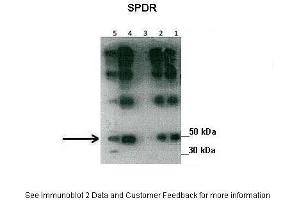 Lanes:   Lane1: 30 ug human placental tissue lysate Lane2: 30 ug human placental tissue lysate Lane3: 30 ug human placental tissue lysate Lane4: 30 ug human placental tissue lysate Lane5: 20 ug human myometrial tissue lysate  Primary Antibody Dilution:   1:500  Secondary Antibody:   Goat anti-rabbit HRP  Secondary Antibody Dilution:   1:10000  Gene Name:   SDPR  Submitted by:   Hiten Mistry, Ania Czajka and Marta Hentschke Ribeiro, King's College London (SDPR antibody  (N-Term))