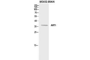 Western Blotting (WB) image for anti-ADP-Ribosyltransferase 1 (ART1) antibody (ABIN5958873) (ART1 antibody)