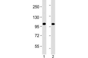 Western blot testing of human 1) Jurkat and 2) K562 cell lysate with PRDM16 antibody at 1:4000. (PRDM16 antibody  (AA 779-996))