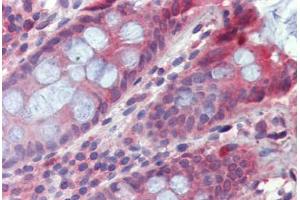 Colon, Human: Formalin-Fixed, Paraffin-Embedded (FFPE) (TPCN2 antibody  (AA 735-747))