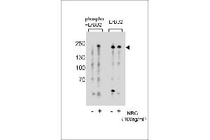 Western blot analysis of extracts from T47D cells, untreated or treated with NRG, 100 ng/mL, using phospho-ErBB2 (left) or ErBB2 Antibody (right). (ErbB2/Her2 antibody  (pTyr877))