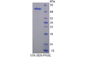 Image no. 1 for Kallikrein 14 (KLK14) (AA 36-267) protein (His tag,GST tag) (ABIN4989806)
