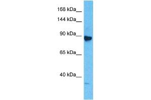 Host:  Rabbit  Target Name:  MCM6  Sample Type:  Jurkat Whole Cell lysates  Antibody Dilution:  1. (MCM6 antibody  (Middle Region))