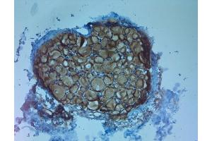 IHC on paraffin sections of rat DRG using Rabbit antibody to TrkC . (NTRK3 antibody)