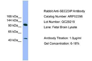 WB Suggested Anti-SEC23IP  Antibody Titration: 0.