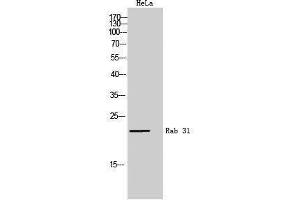 Western Blotting (WB) image for anti-RAB31, Member RAS Oncogene Family (RAB31) (Internal Region) antibody (ABIN3177069) (RAB31 antibody  (Internal Region))