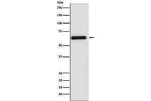 Western blot analysis of PARP2 expression in Raji cell lysate.