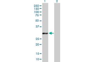 Western Blot analysis of GCLM expression in transfected 293T cell line by GCLM MaxPab polyclonal antibody.