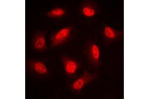 Immunofluorescent analysis of LIMK1/2 (pT508/505) staining in PC12 cells. (LIMK-1/2 (C-Term), (pSer505), (pSer508) antibody)