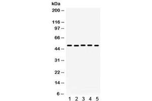 Western blot testing of 1) rat brain, 2) rat kidney, 3) human placenta, 4) HeLa, 5) A431 lysate with Galectin 8 antibody.