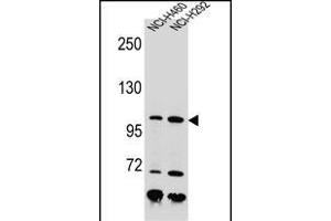 NBN Antibody (C-term) (ABIN655721 and ABIN2845169) western blot analysis in NCI-,NCI- cell line lysates (35 μg/lane). (Nibrin antibody  (C-Term))