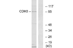 Immunohistochemistry analysis of paraffin-embedded human brain tissue using CDH3 antibody. (P-Cadherin antibody)