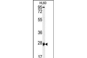 Western blot analysis of DPT antibody (Center) (ABIN391701 and ABIN2841600) in HL60 cell line lysates (35 μg/lane). (Dermatopontin antibody  (AA 102-128))