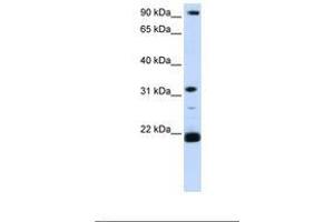 Image no. 1 for anti-Vacuolar-sorting Protein SNF8 (SNF8) (C-Term) antibody (ABIN6739063) (SNF8 antibody  (C-Term))