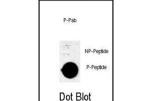 Dot blot analysis of anti-Phospho-AKT1 (Thr308) Antibody Phospho-specific Pab (ABIN650880 and ABIN2839823) on nitrocellulose membrane. (AKT1 antibody  (pThr308))
