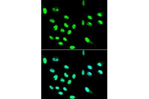 Immunofluorescence analysis of HepG2 cells using FCGR2A antibody (ABIN5970646).