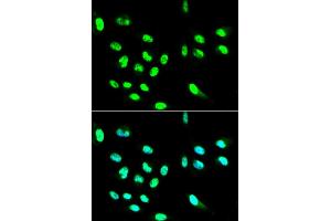 Immunofluorescence analysis of HepG2 cells using FCGR2A antibody (ABIN5970646). (FCGR2A antibody)