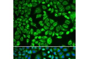 Immunofluorescence analysis of MCF-7 cells using PSMD7 Polyclonal Antibody (PSMD7 antibody)