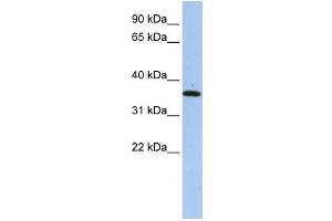 Western Blotting (WB) image for anti-Family with Sequence Similarity 84, Member A (FAM84A) antibody (ABIN2459583)