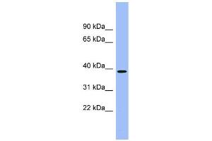 Human kidney; WB Suggested Anti-ACMSD Antibody Titration: 0. (ACMSD antibody  (Middle Region))