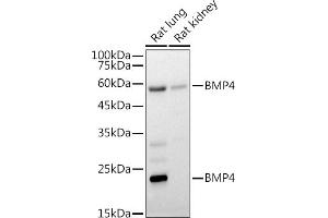 Western blot analysis of extracts of various cell lines, using BMP4 antibody (ABIN6127497, ABIN6137600, ABIN6137603 and ABIN6215157) at 1:1000 dilution. (BMP4 antibody  (AA 1-408))