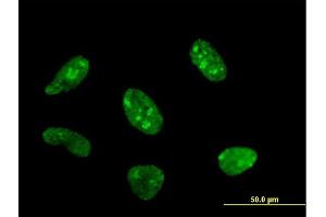 Immunofluorescence of monoclonal antibody to POLR1C on HeLa cell. (POLR1C antibody  (AA 1-346))