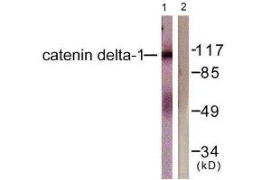 Western Blotting (WB) image for anti-Catenin (Cadherin-Associated Protein), delta 1 (CTNND1) (Tyr228) antibody (ABIN1848016) (CTNND1 antibody  (Tyr228))